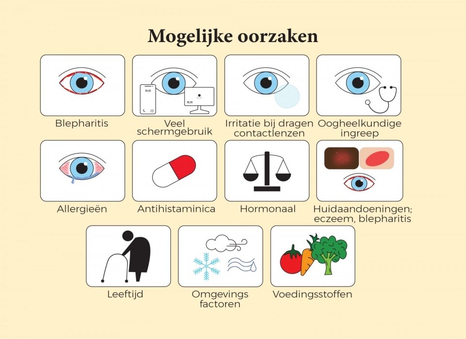oorzaken-droge-ogen.jpg